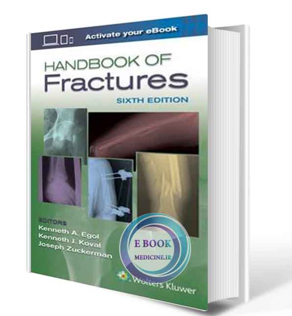 دانلود کتابHandbook of Fractures 6th 2020 ( PDF)